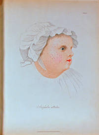 Delineations of cutaneous diseases, exhibiting the characteristic appearances of the principal genera and species comprised in the classification of the late Dr. Willan: and completing the series of engravings begun by that author