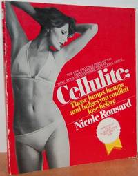 Cellulite: Those Lumps, Bumps, and Bulges You Couldn't Lose Before