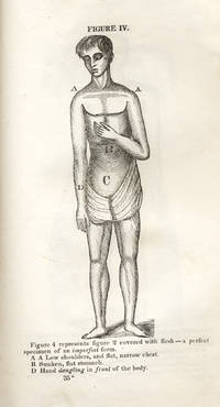 Common Sense on Chronic Diseases; or, A Rational Treatise on the Mechanical Cause and Cure of Most Chronic Affections of the Truncal Organs, of Both Male and Female Systems, Embracing the Author's Views on Physical Education, and the Present Popular System of Artificial Life