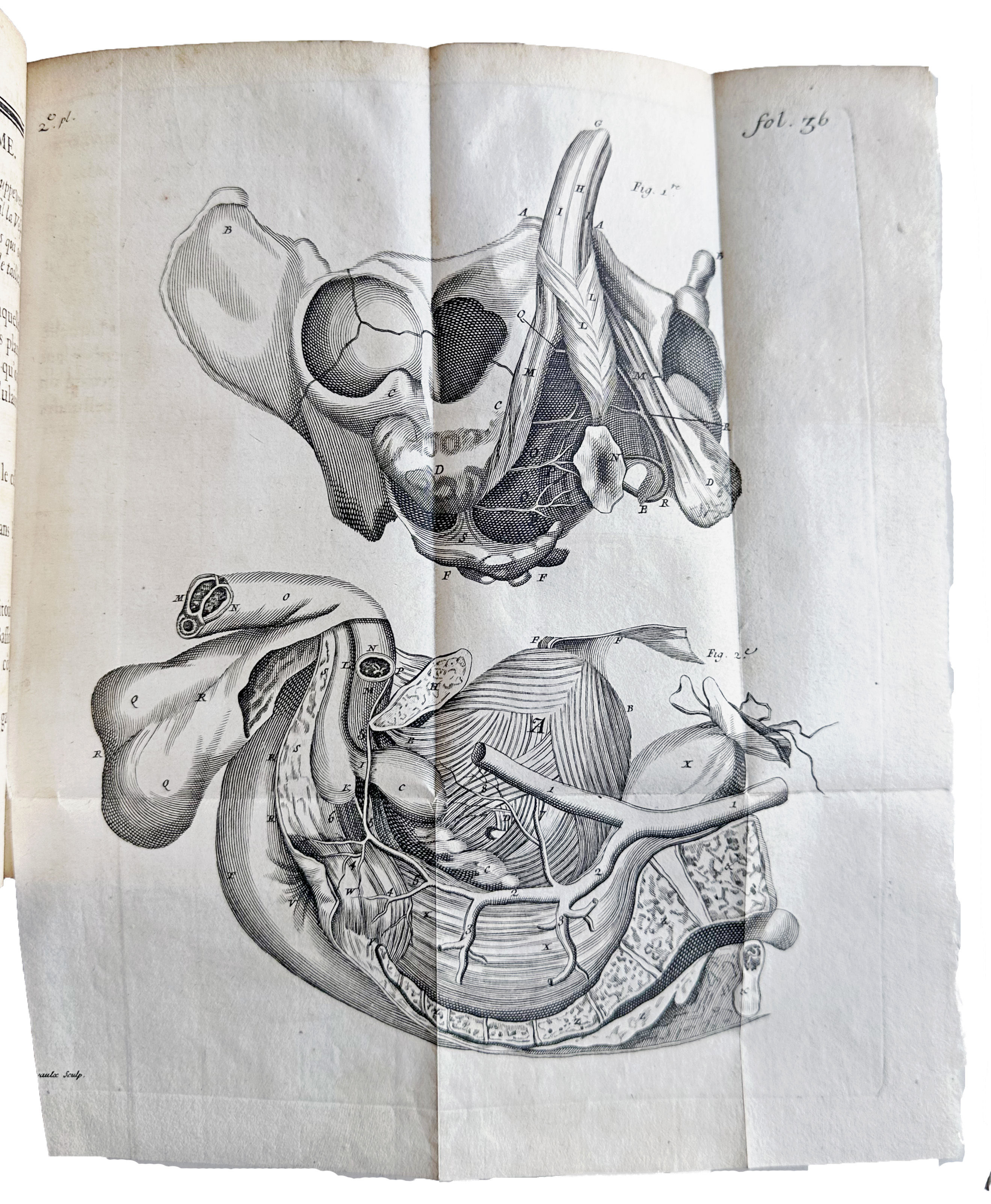 Image for Parallele des Differentes Manieres de tirer la pierre hors de la vessie. Parallele des Differentes Manieres de tirer la pierre hors de la vessie.
